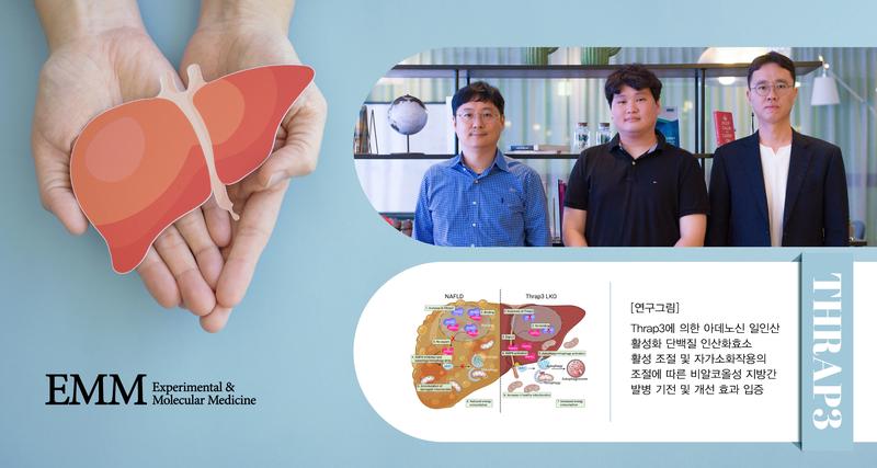 비알코올성 지방간 치료제 개발의 실마리 풀렸다!